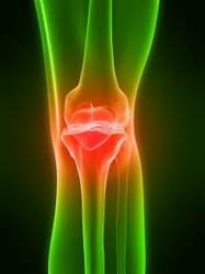 Zimmer NexGen Knee: severe complications threat